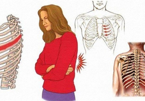 Hỗ trợ điều trị đau dây thần kinh liên sườn bằng Diện Chẩn